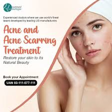 Acne Scars