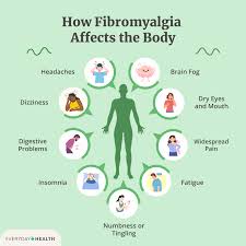 fibromyalgia
