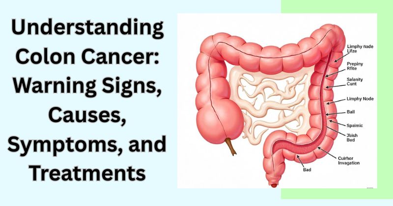 Understanding Colon Cancer Warning Signs, Causes, Symptoms, and Treatments