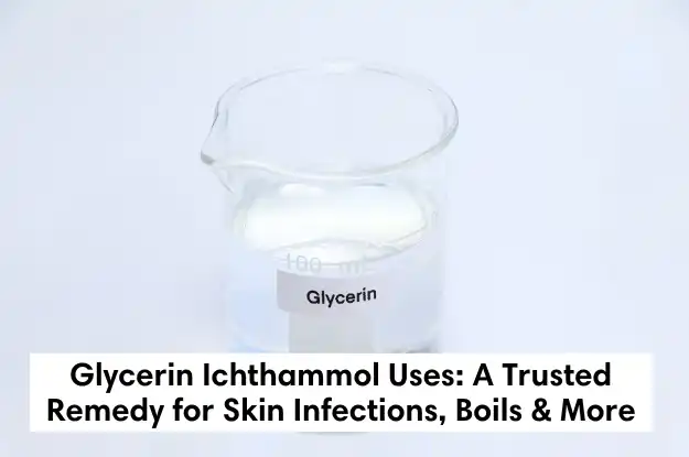 glycerin ichthammol uses