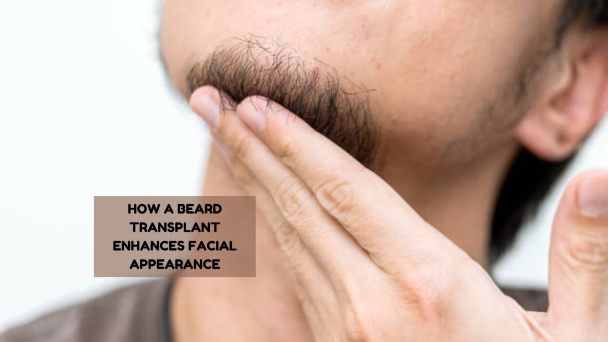 beard transplant